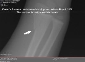 Keefer's x-ray. Click for enlargement!